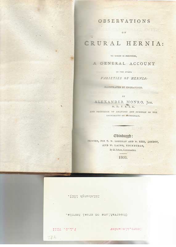 Monro, A. Hernia 1803