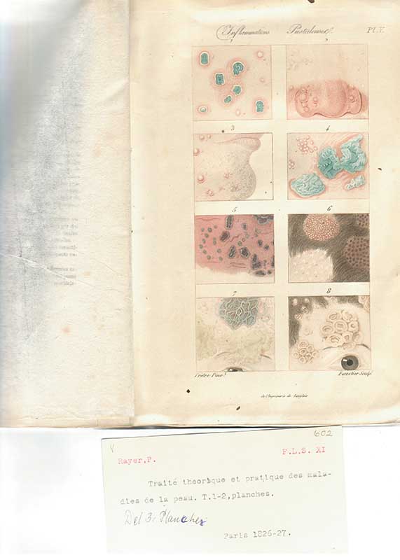 Rayer, P. Hudsjukdomar bilder 1827
